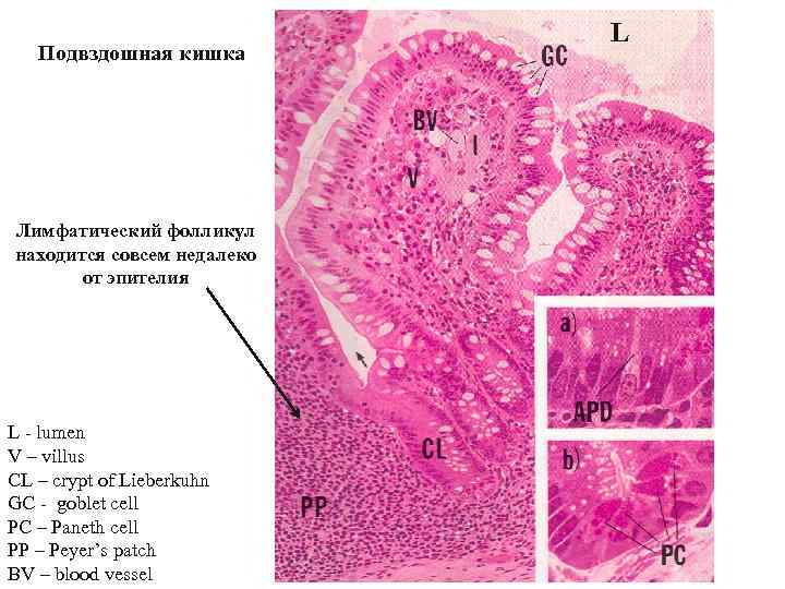 Подвздошная кишка Лимфатический фолликул находится совсем недалеко от эпителия L - lumen V –