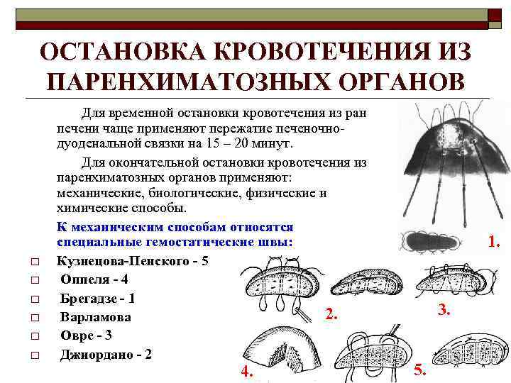 ОСТАНОВКА КРОВОТЕЧЕНИЯ ИЗ ПАРЕНХИМАТОЗНЫХ ОРГАНОВ o o o Для временной остановки кровотечения из ран