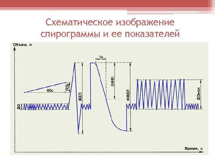 Схематическое изображение спирограммы и ее показателей 