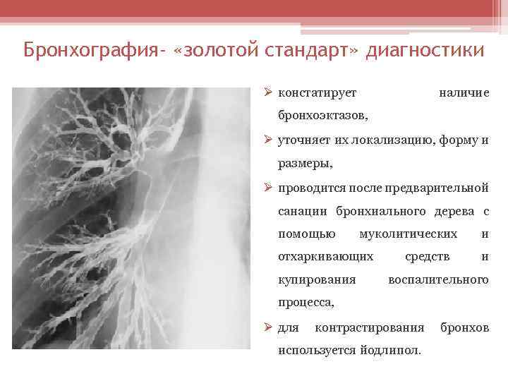 Бронхография- «золотой стандарт» диагностики Ø констатирует наличие бронхоэктазов, Ø уточняет их локализацию, форму и