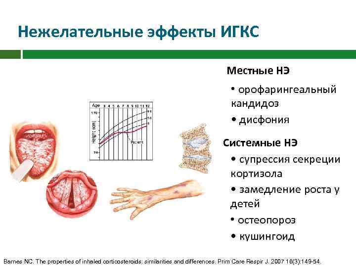 Нежелательные эффекты ИГКС Местные НЭ • орофарингеальный кандидоз • дисфония Системные НЭ • супрессия