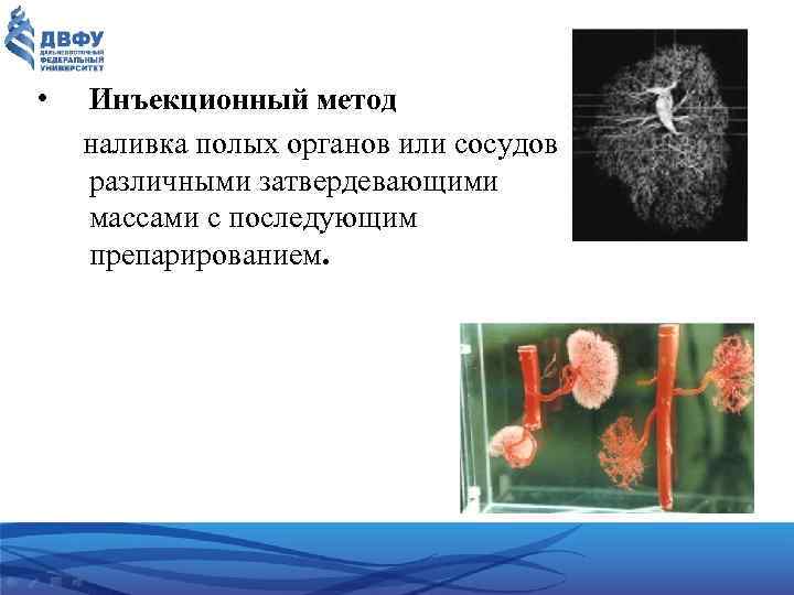  • Инъекционный метод наливка полых органов или сосудов различными затвердевающими массами с последующим