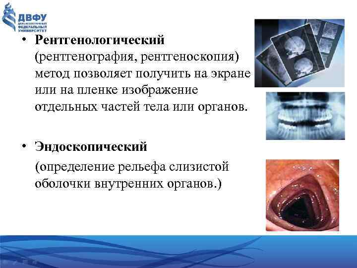  • Рентгенологический (рентгенография, рентгеноскопия) метод позволяет получить на экране или на пленке изображение