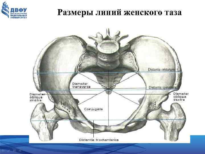 Размеры линий женского таза 