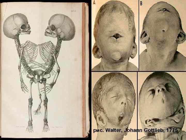 127 рис. Walter, Johann Gottlieb, 1775 