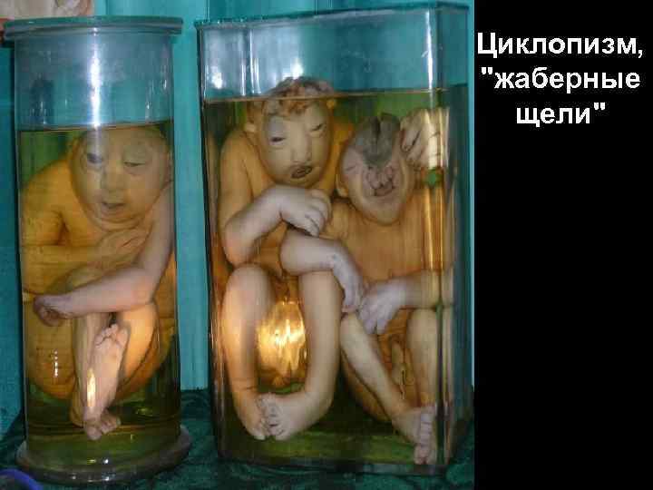 Циклопизм, "жаберные щели" 128 