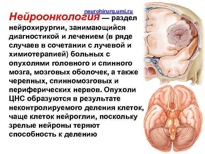 neurohirurg. umi. ru Нейроонкология — раздел нейрохирургии, занимающийся диагностикой и лечением (в ряде случаев