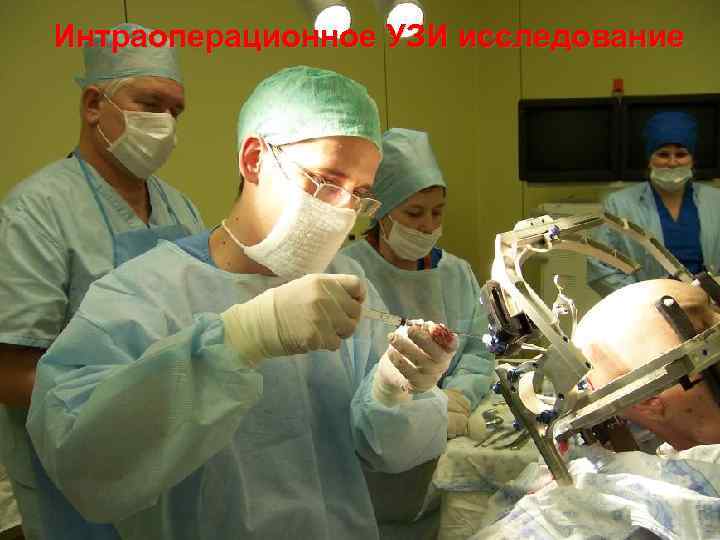 Интраоперационное УЗИ исследование 41 