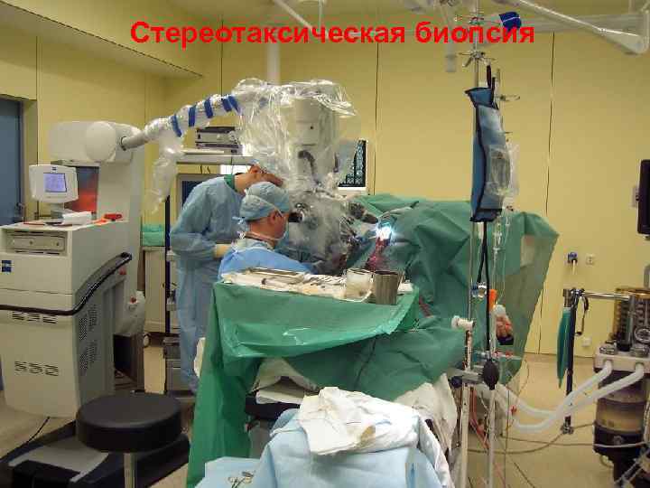 Стереотаксическая биопсия 42 