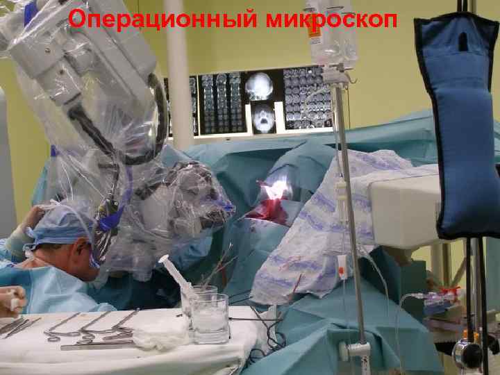 Операционный микроскоп 43 