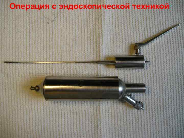 Операция с эндоскопической техникой 45 