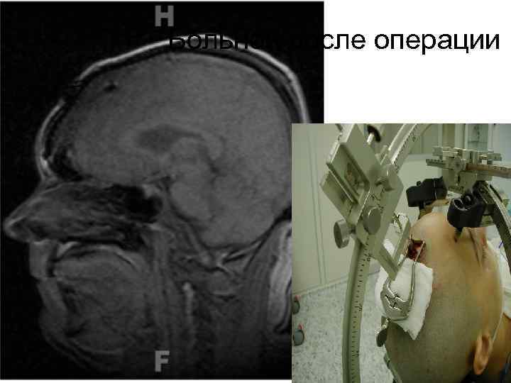 Больной после операции 66 