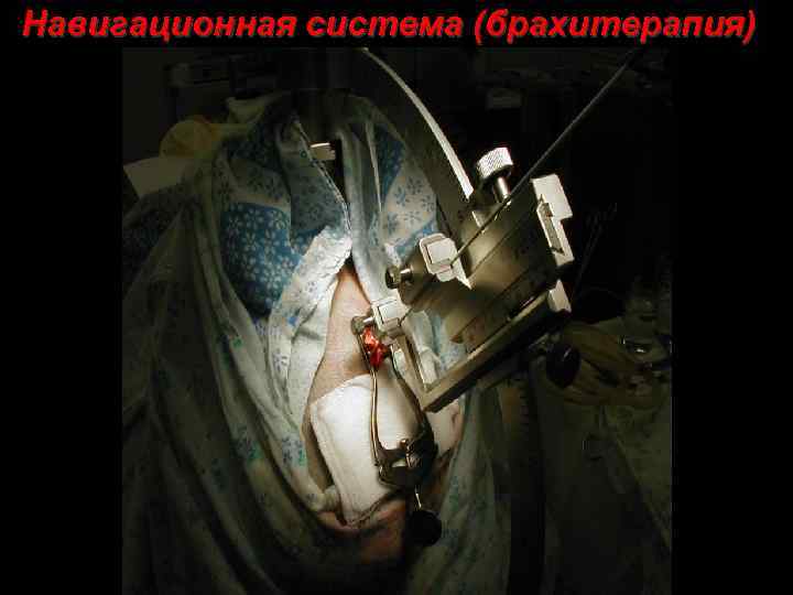 Навигационная система (брахитерапия) 70 