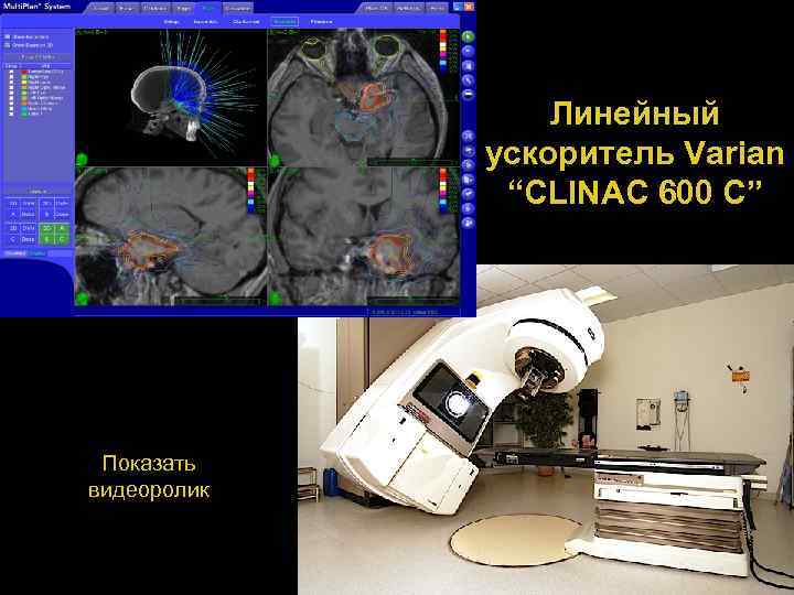 Линейный ускоритель Varian “CLINAC 600 C” Показать видеоролик 80 