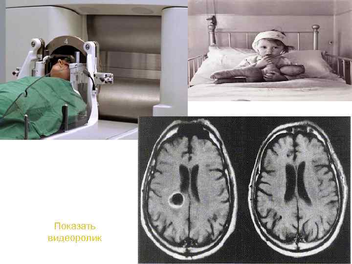 Показать видеоролик 83 