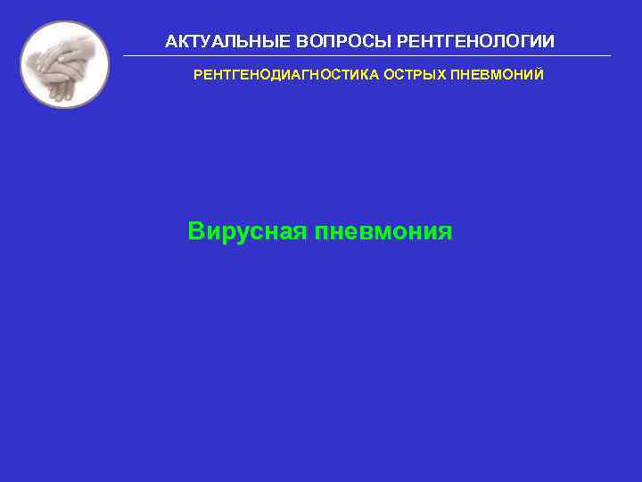 АКТУАЛЬНЫЕ ВОПРОСЫ РЕНТГЕНОЛОГИИ РЕНТГЕНОДИАГНОСТИКА ОСТРЫХ ПНЕВМОНИЙ Вирусная пневмония 