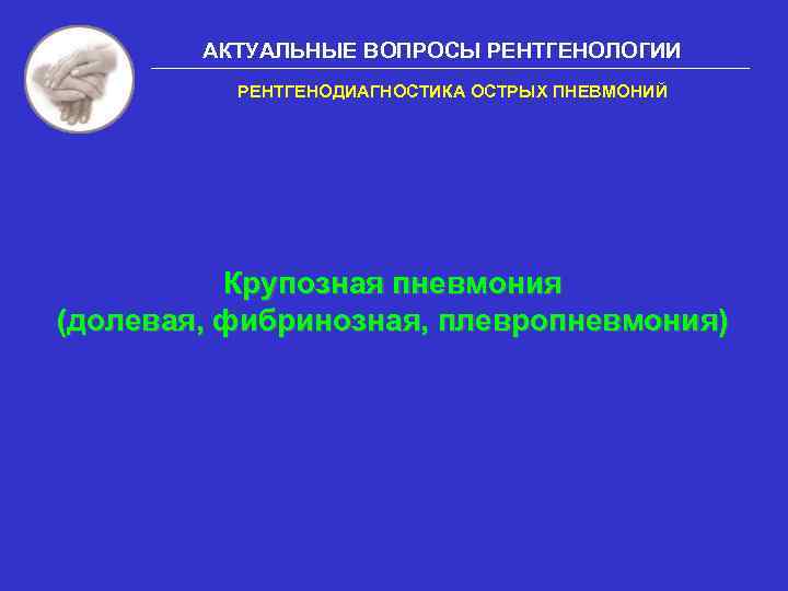 АКТУАЛЬНЫЕ ВОПРОСЫ РЕНТГЕНОЛОГИИ РЕНТГЕНОДИАГНОСТИКА ОСТРЫХ ПНЕВМОНИЙ Крупозная пневмония (долевая, фибринозная, плевропневмония) 