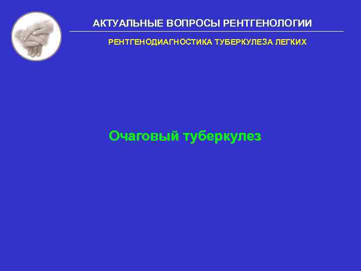 АКТУАЛЬНЫЕ ВОПРОСЫ РЕНТГЕНОЛОГИИ РЕНТГЕНОДИАГНОСТИКА ТУБЕРКУЛЕЗА ЛЕГКИХ Очаговый туберкулез 