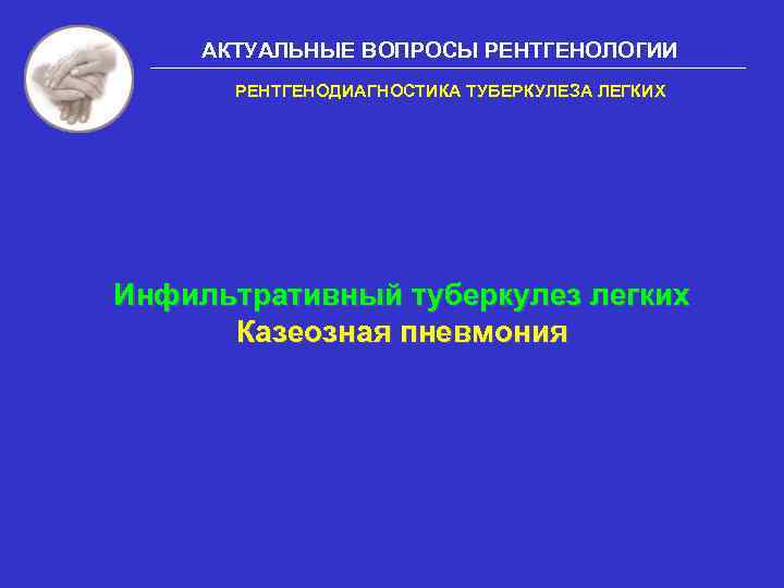 АКТУАЛЬНЫЕ ВОПРОСЫ РЕНТГЕНОЛОГИИ РЕНТГЕНОДИАГНОСТИКА ТУБЕРКУЛЕЗА ЛЕГКИХ Инфильтративный туберкулез легких Казеозная пневмония 