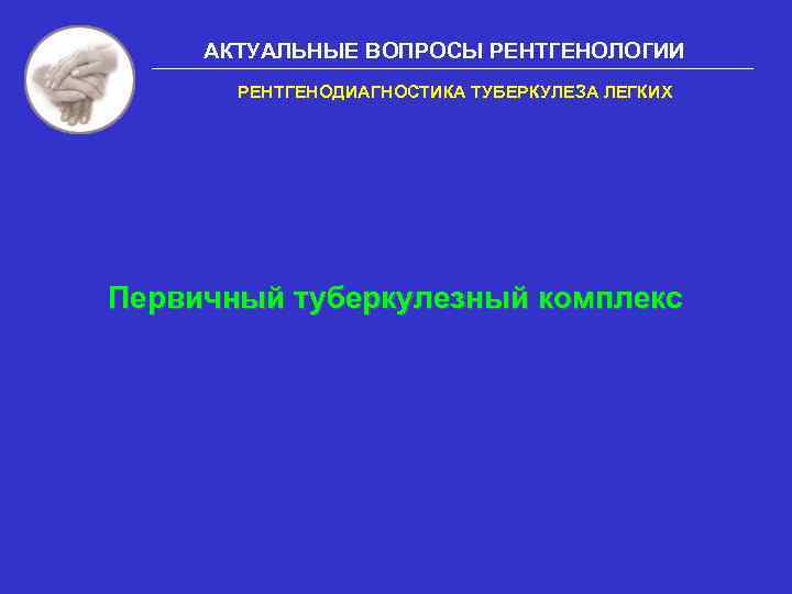 АКТУАЛЬНЫЕ ВОПРОСЫ РЕНТГЕНОЛОГИИ РЕНТГЕНОДИАГНОСТИКА ТУБЕРКУЛЕЗА ЛЕГКИХ Первичный туберкулезный комплекс 