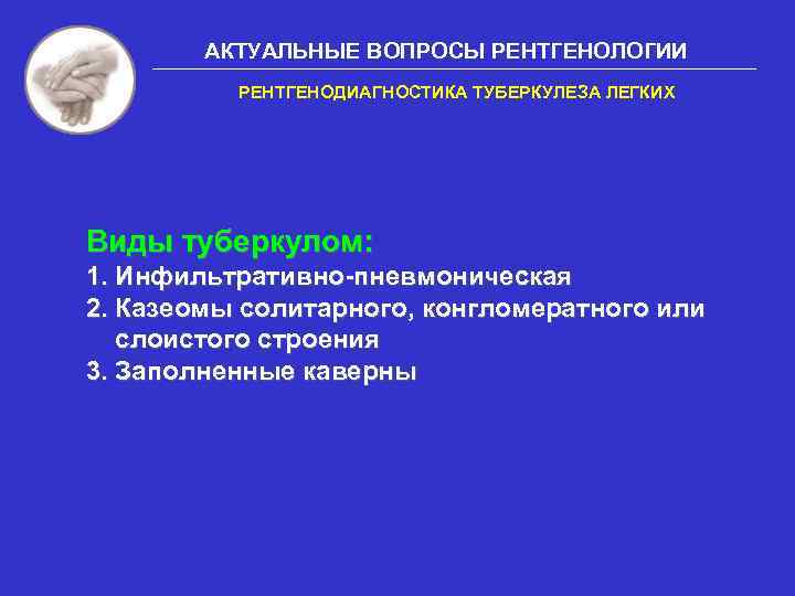 АКТУАЛЬНЫЕ ВОПРОСЫ РЕНТГЕНОЛОГИИ РЕНТГЕНОДИАГНОСТИКА ТУБЕРКУЛЕЗА ЛЕГКИХ Виды туберкулом: 1. Инфильтративно-пневмоническая 2. Казеомы солитарного, конгломератного