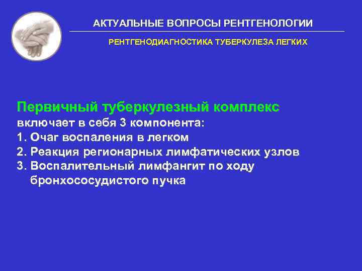 АКТУАЛЬНЫЕ ВОПРОСЫ РЕНТГЕНОЛОГИИ РЕНТГЕНОДИАГНОСТИКА ТУБЕРКУЛЕЗА ЛЕГКИХ Первичный туберкулезный комплекс включает в себя 3 компонента: