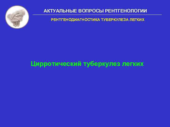 АКТУАЛЬНЫЕ ВОПРОСЫ РЕНТГЕНОЛОГИИ РЕНТГЕНОДИАГНОСТИКА ТУБЕРКУЛЕЗА ЛЕГКИХ Цирротический туберкулез легких 