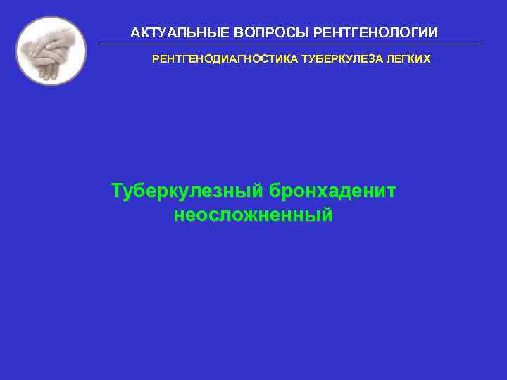 АКТУАЛЬНЫЕ ВОПРОСЫ РЕНТГЕНОЛОГИИ РЕНТГЕНОДИАГНОСТИКА ТУБЕРКУЛЕЗА ЛЕГКИХ Туберкулезный бронхаденит неосложненный 