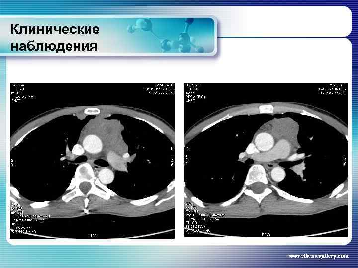 Клинические наблюдения www. themegallery. com 