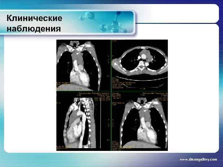 Клинические наблюдения www. themegallery. com 