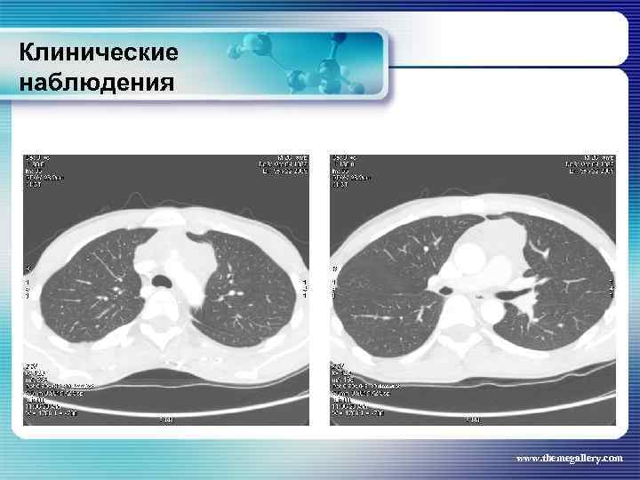 Клинические наблюдения www. themegallery. com 