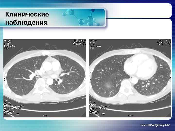 Клинические наблюдения www. themegallery. com 