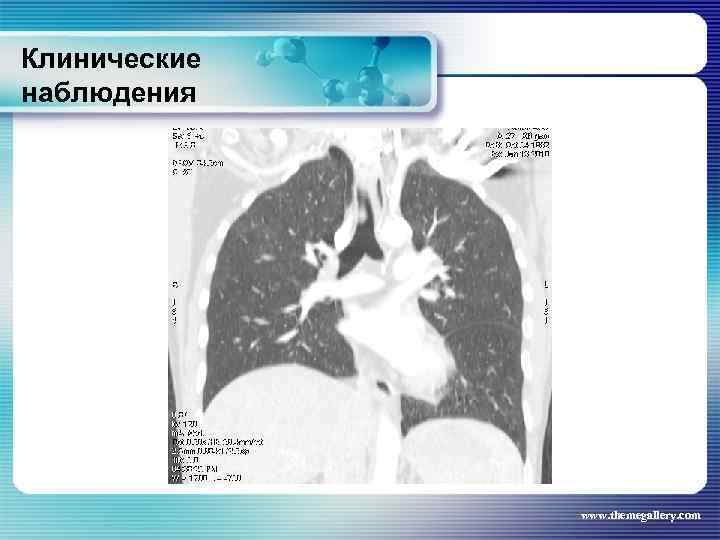 Клинические наблюдения www. themegallery. com 