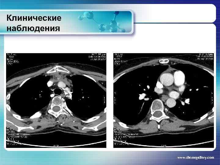 Клинические наблюдения www. themegallery. com 