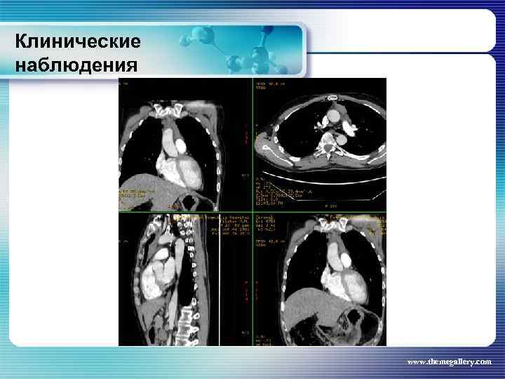 Клинические наблюдения www. themegallery. com 