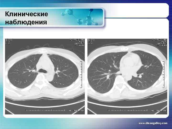Клинические наблюдения www. themegallery. com 