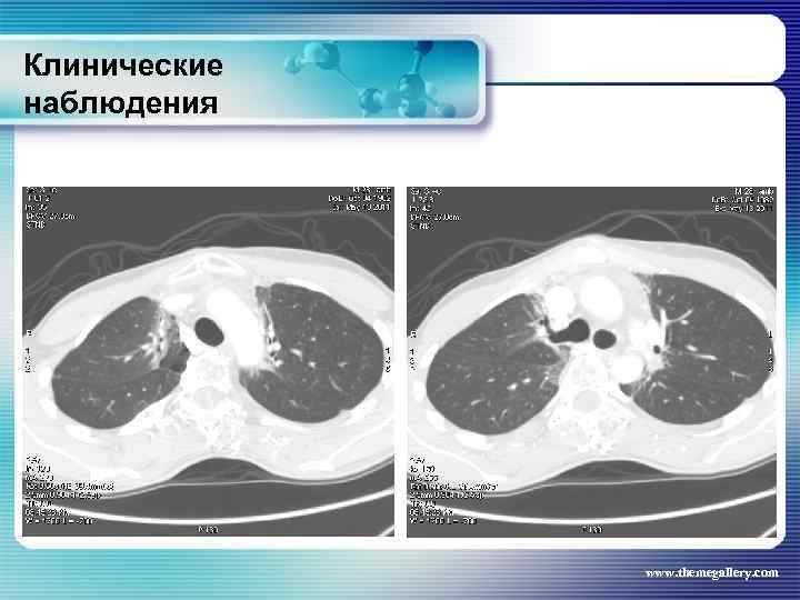 Клинические наблюдения www. themegallery. com 