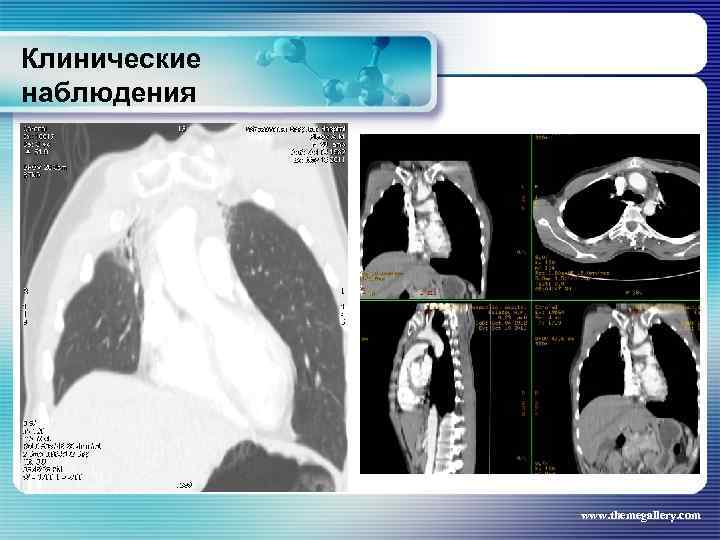 Клинические наблюдения www. themegallery. com 