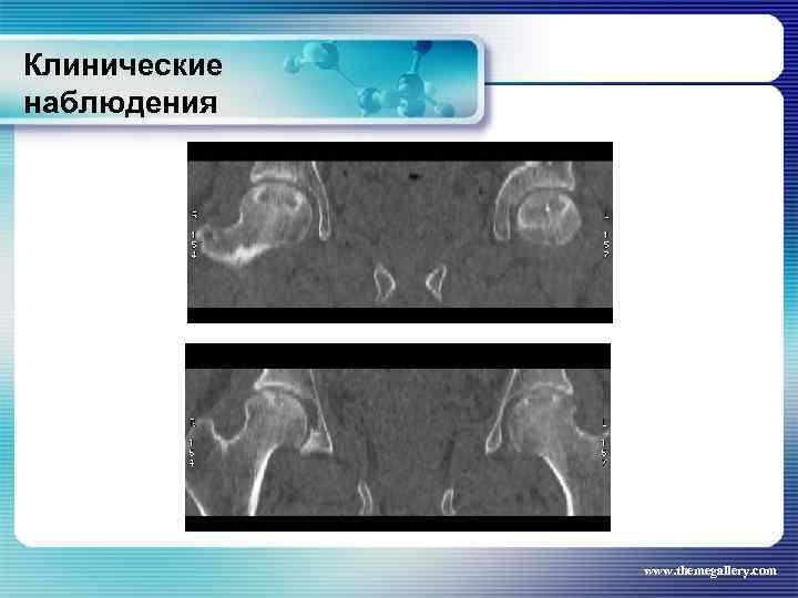 Клинические наблюдения www. themegallery. com 