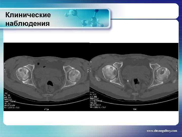 Клинические наблюдения www. themegallery. com 