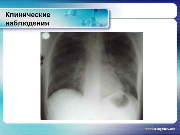 Клинические наблюдения www. themegallery. com 