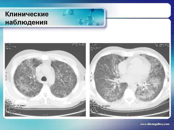 Клинические наблюдения www. themegallery. com 