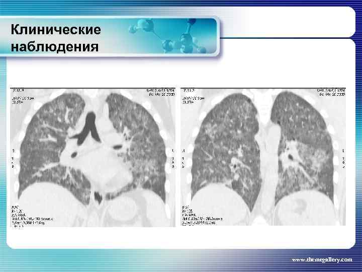 Клинические наблюдения www. themegallery. com 