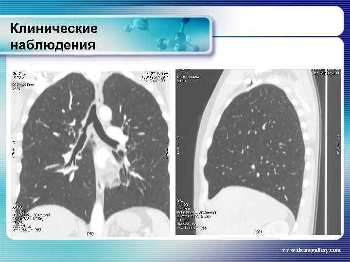 Клинические наблюдения www. themegallery. com 