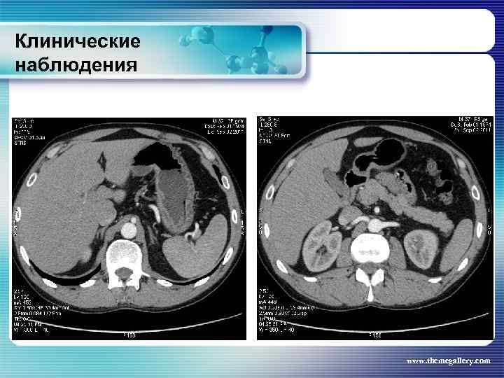 Клинические наблюдения www. themegallery. com 