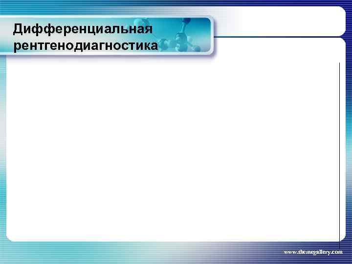 Дифференциальная рентгенодиагностика www. themegallery. com 