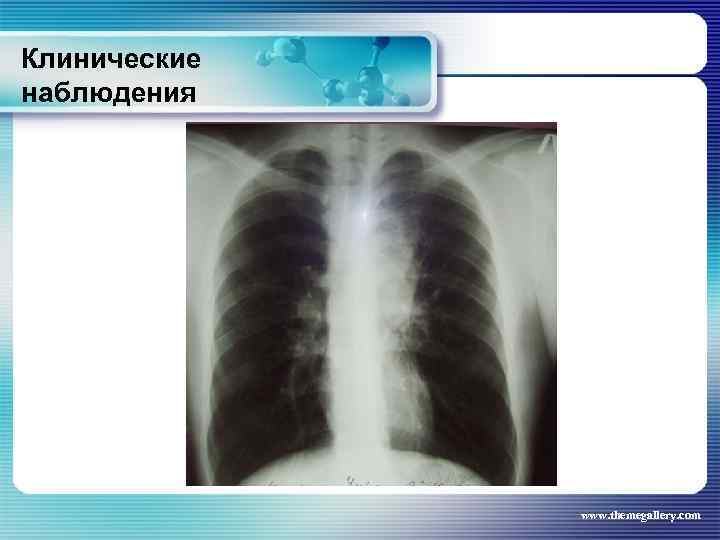 Клинические наблюдения www. themegallery. com 