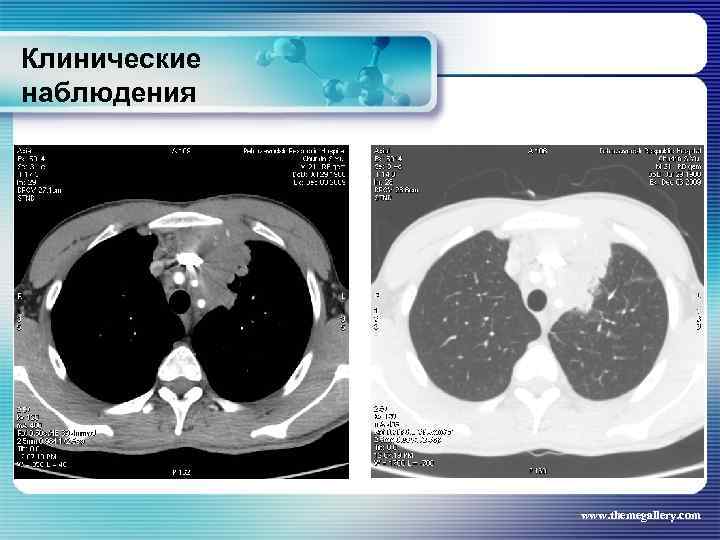 Клинические наблюдения www. themegallery. com 