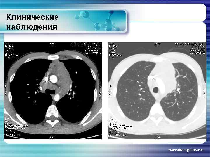 Клинические наблюдения www. themegallery. com 