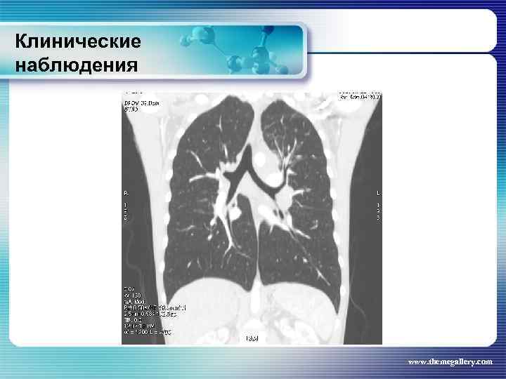 Клинические наблюдения www. themegallery. com 